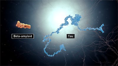 Beta-amyloid and tau.