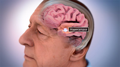 Location of the hippocampus in the brain.