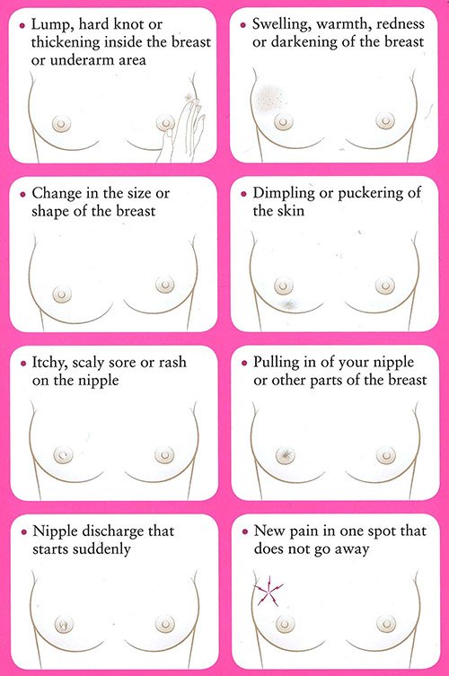 Possible warning signs of breast cancer