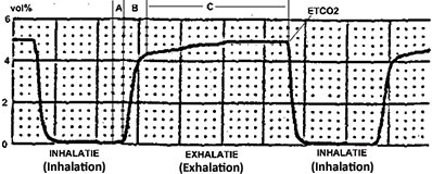 Capnography waveform results